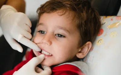 Cárie Dentária nas Crianças
