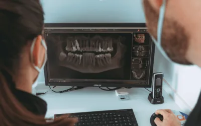 Implantes Dentários: conheça as principais vantagens