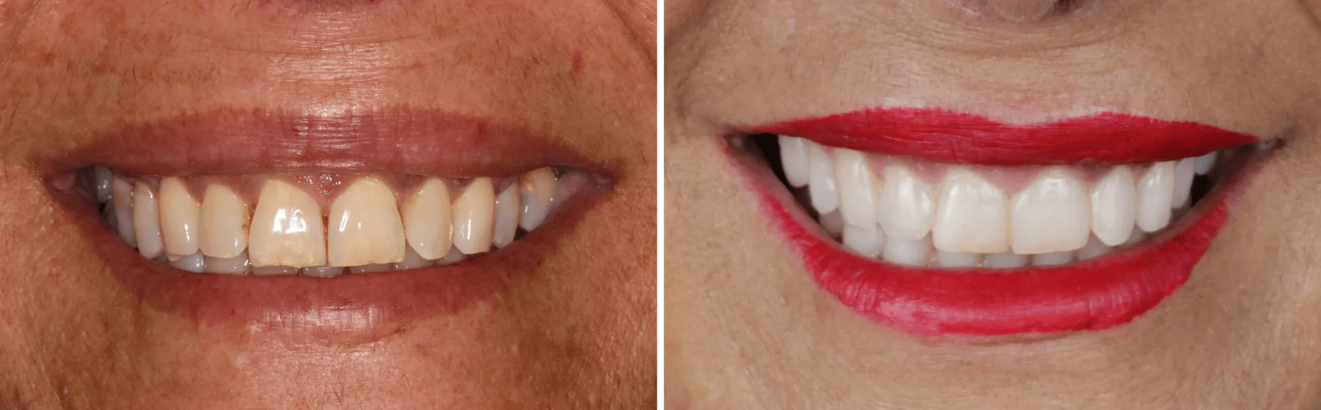 #11 Cirurgia Oral, Endodontia, Dentisteria e Harmonização Facial